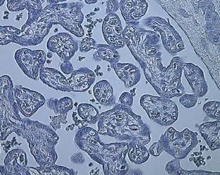 HIF-1 alpha Antibody (MA5-16019) in IHC