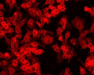 HIF-1 alpha Antibody (MA5-16019) in IF