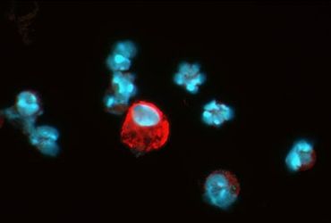 HIF-1 alpha Antibody (MA5-16019) in IF