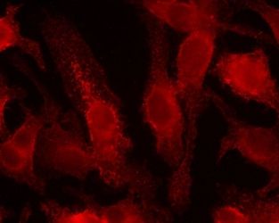 HIF-1 alpha Antibody (MA5-16019) in IF
