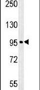 Western blot analysis using a CO039 polyclonal antibody (Product # PA5-23511) in A549 cells lysates (35ug per lane).