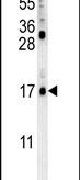 Western blot analysis using a LCE2B polyclonal antibody (Product # PA5-23538) in K562 cell lysates (35ug per lane).