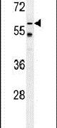 Western blot analysis in mouse liver tissue lysates (15ug per lane) using a TYSND1 polyclonal antibody (Product # PA5-23587).