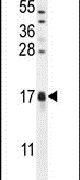 Western blot analysis using a CAMK2N1 polyclonal antibody (Product # PA5-23740) in mouse testis tissue lysates (35ug per lane).