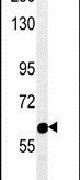 Western blot analysis in SK-BR-3 cell lysates (15ug per lane) using a RADIL polyclonal antibody (Product # PA5-23742).