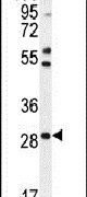 Western blot analysis using a RNF183 polyclonal antibody (Product # PA5-23862) in mouse heart tissue lysates (35ug per lane).