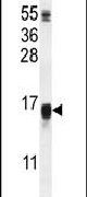 Western blot analysis using a WFDC12 polyclonal antibody (Product # PA5-23873) in A549 cells lysates (35ug per lane).