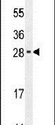 Western blot analysis using a RELL2 polyclonal antibody (Product # PA5-23910) in mouse testis tissue lysates (35ug per lane).