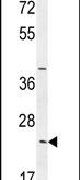 Western blot analysis using a SYCE2 polyclonal antibody (Product # PA5-23917) in MDA-MB231 cell lysates (35ug per lane).