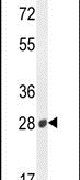 Western blot analysis using a B3GAT2 polyclonal antibody (Product # PA5-23973) in mouse heart tissue lysates (35ug per lane).