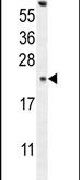 Western blot analysis using a GAGE13 polyclonal antibody (Product # PA5-24068) in K562 cell lysates (35ug per lane).