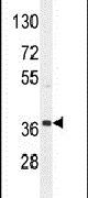 Western blot analysis using a NKAPL polyclonal antibody (Product # PA5-24089) in A2058 cell lysates (35ug per lane).