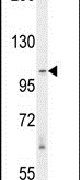 Western blot analysis using a RASAL3 polyclonal antibody (Product # PA5-24097) in Y79 cell lysates (35ug per lane).