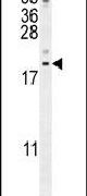 Western blot analysis using a LYRM4 polyclonal antibody (Product # PA5-24175) in MDA-MB435 cell lysates (35ug per lane).