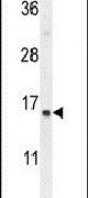 Western blot analysis using a SPRR2A polyclonal antibody (Product # PA5-24249) in MDA-MB231 cell lysates (35ug per lane).