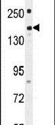 Western blot analysis using a PKHG1 polyclonal antibody (Product # PA5-24285) in 293 cell lysates (35ug per lane).