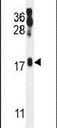 Western blot analysis using an ORML2 polyclonal antibody (Product # PA5-24302) in mouse stomach tissue lysates (35ug per lane).