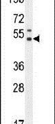 Western blot analysis using a PUS3 polyclonal antibody (Product # PA5-24321) in ZR-75-1 cell lysates (35ug per lane).