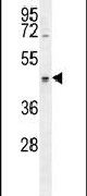 Western blot analysis using a CCDC122 polyclonal antibody (Product # PA5-24342) in CEM cell lysates (35ug per lane).