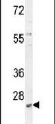 Western blot analysis using a MCART2 polyclonal antibody (Product # PA5-24374) in K562 cell lysates (35ug per lane).