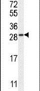 Western blot analysis using a TIFAB polyclonal antibody (Product # PA5-24376) in mouse bladder tissue lysates (35ug per lane).