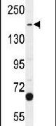 Western blot analysis using a TDRD7 polyclonal antibody (Product # PA5-24462) in A549 cells lysates (35ug per lane).