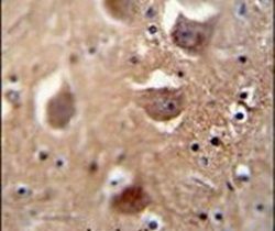Immunohistochemistry analysis in formalin-fixed, paraffin-embedded human brain tissue using a TDRD7 polyclonal antibody (Product ## PA5-24462), followed by HRP-conjugated secondary antibody and DAB staining.