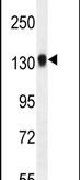 Western blot analysis using a TDRD7 polyclonal antibody (Product # PA5-24462) in mouse bladder tissue lysates (35ug per lane).