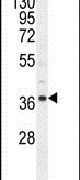 Western blot analysis using a NDUF3 polyclonal antibody (Product # PA5-24469) in mouse heart tissue lysates (35ug per lane).