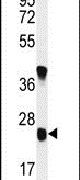 Western blot analysis using a U119B polyclonal antibody (Product # PA5-24504) in mouse kidney tissue lysates (35ug per lane).