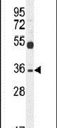 Western blot analysis using a SULT1C3 polyclonal antibody (Product # PA5-24548) in K562 cell lysates (35ug per lane).