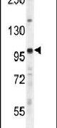 Western blot analysis using a UNK polyclonal antibody (Product # PA5-24557) in mouse lung tissue lysates (35ug per lane).