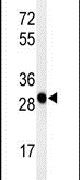 Western blot analysis using a PAQR3 polyclonal antibody (Product # PA5-24654) in WiDr cell lysates (35ug per lane).
