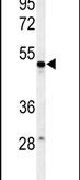 Western blot analysis using a PSG7 polyclonal antibody (Product # PA5-24864) in MCF-7 cell lysates (35ug per lane).