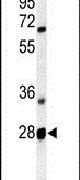 Western blot analysis using a RTP2 polyclonal antibody (Product # PA5-24995) in mouse liver tissue lysates (35ug per lane).