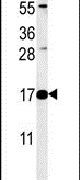 Western blot analysis using a RNASEK polyclonal antibody (Product # PA5-25183) in A2058 cell lysates (35ug per lane).