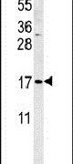 Western blot analysis using a SMAGP polyclonal antibody (Product # PA5-25195) in K562 cell lysates (35ug per lane).
