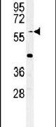 Western blot analysis using a YLAT2 polyclonal antibody (Product # PA5-25223) in HepG2 cell lysates (35ug per lane).