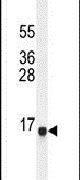 Western blot analysis using a SPAG11A polyclonal antibody (Product # PA5-24323) in NCI-H292 cell lysates (35ug per lane).