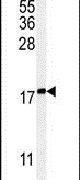 Western blot analysis using a KRTAP1-1 polyclonal antibody (Product # PA5-25474) in K562 cell lysates (35ug per lane).