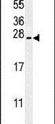 Western blot analysis using a SRTD3 polyclonal antibody (Product # PA5-25820) in mouse stomach tissue lysates (35ug per lane).