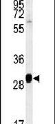 Western blot analysis in NCI-H460 cell lysates (15ug per lane) using a SC31B polyclonal antibody (Product # PA5-25528).