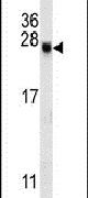 Western blot analysis in mouse spleen tissue lysates (15ug per lane) using an EID2 polyclonal antibody (Product # PA5-25543).