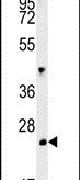 Western blot analysis in mouse kidney tissue lysates (15ug per lane) using a LHPL3 polyclonal antibody (Product # PA5-25625).