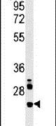 Western blot analysis in MDA-MB435 cell lysates (15ug per lane) using a LHPL3 polyclonal antibody (Product # PA5-25625).