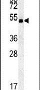 Western blot analysis in mouse cerebellum tissue lysates (15ug per lane) using a Shisa7 polyclonal antibody (Product # PA5-25713).