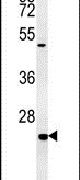 Western blot analysis in mouse kidney tissue lysates (15ug per lane) using a SHISA2 polyclonal antibody (Product # PA5-25853).