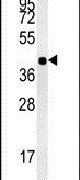 Western blot analysis in mouse heart tissue lysates (15ug per lane) using a ISPD polyclonal antibody (Product # PA5-25854).