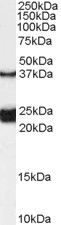 Western Blot staining of Rat Spinal Cord lysate using PA5-18629 at a concentration of 0.1 ug/ml, the primary antibody incubation was 1 hour and the detection method was chemiluminescence.
