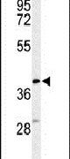 Western blot analysis using a CYTB polyclonal antibody (Product # PA5-26626) in HL-60 cell lysates (35ug per lane).